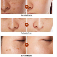 Astragalus Dark Spot Corrector Cream