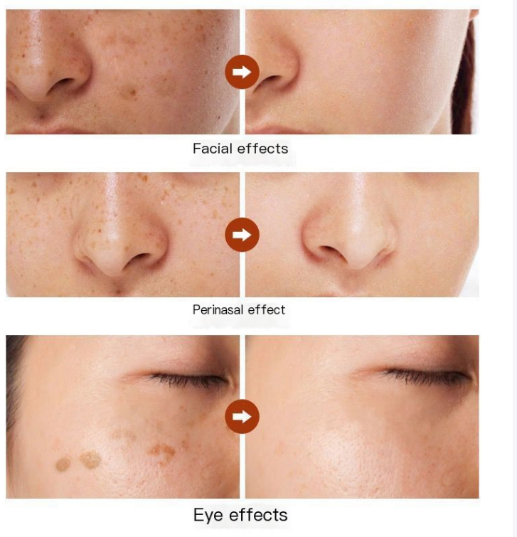 Astragalus Dark Spot Corrector Cream